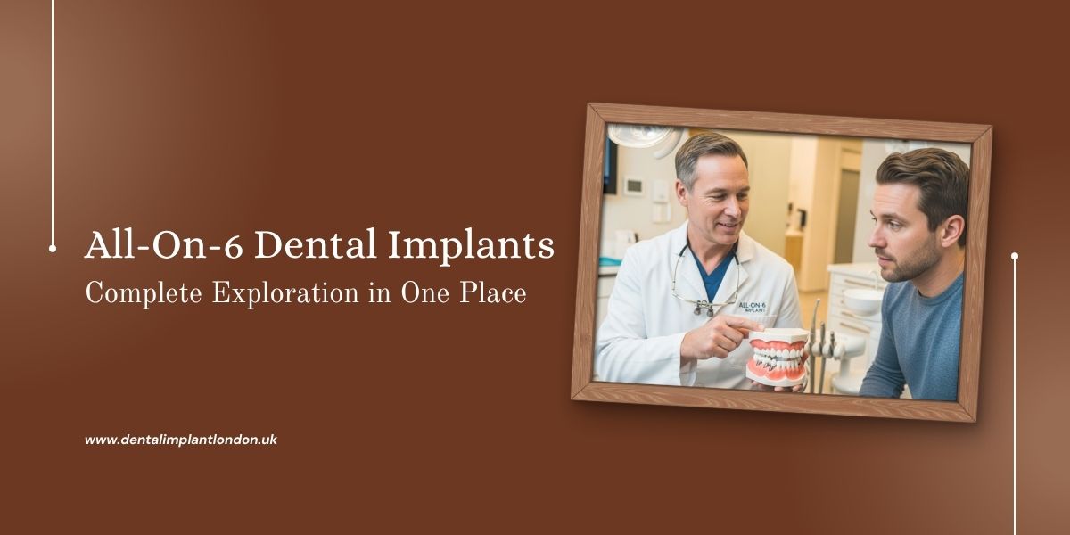 All on 6 dental Implants in London