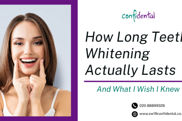 How Long Teeth Whitening Actually Lasts (And What I Wish I Knew) Best teeth whitening in Wimbledon