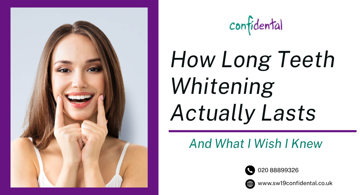 Best teeth whitening in Wimbledon