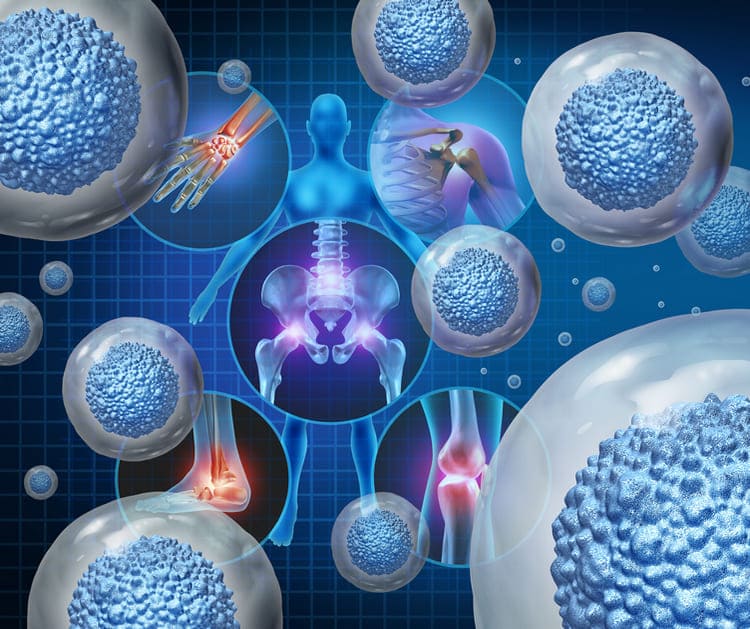 Regenerative Stem Cell Therapy