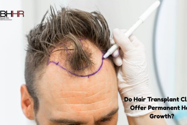 Do Hair Transplant Clinics Offer Permanent Hair Growth? hair transplant clinic