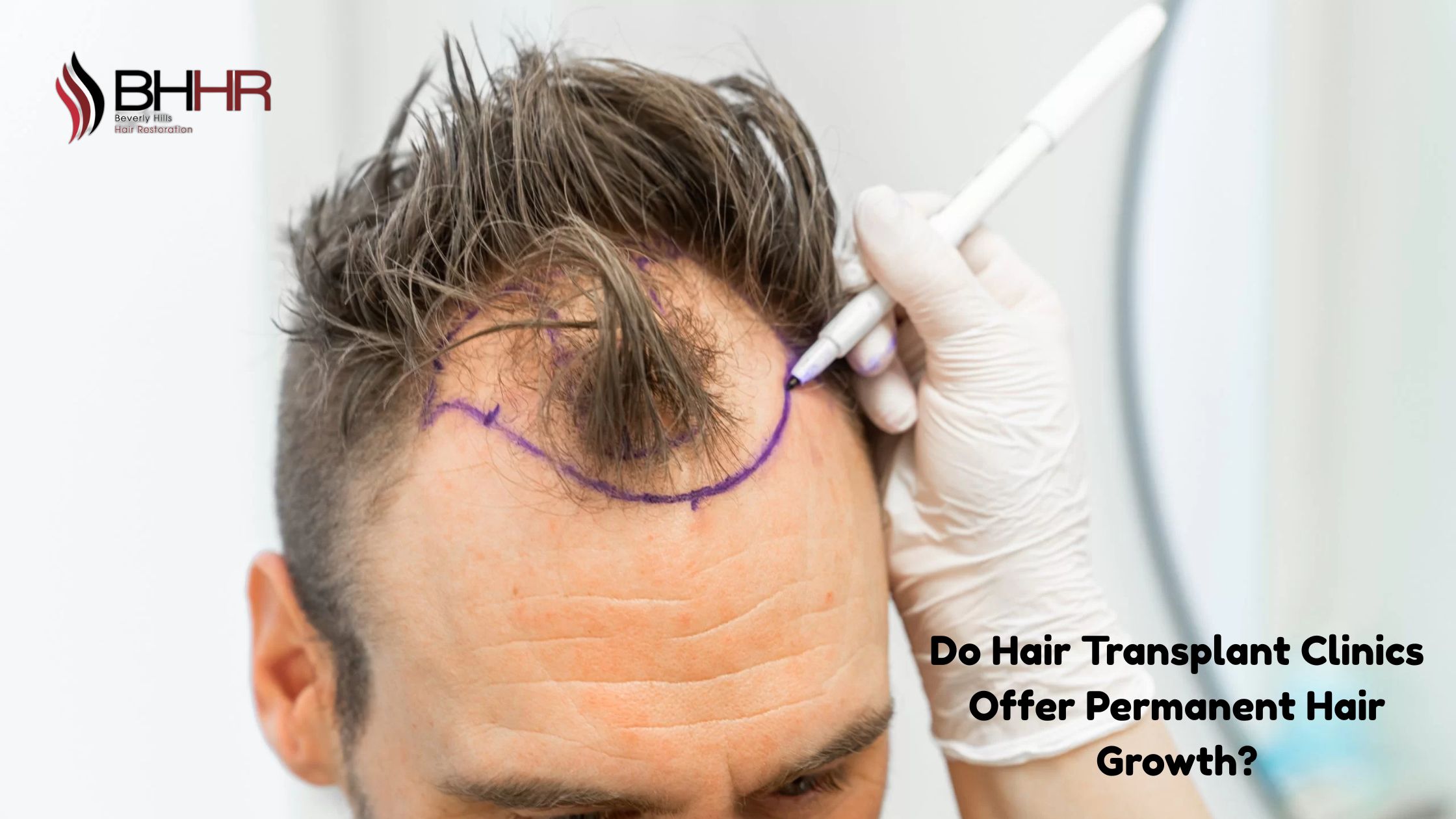 hair transplant clinic