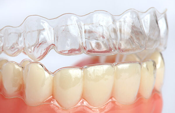 invisible aligners Williamsport
