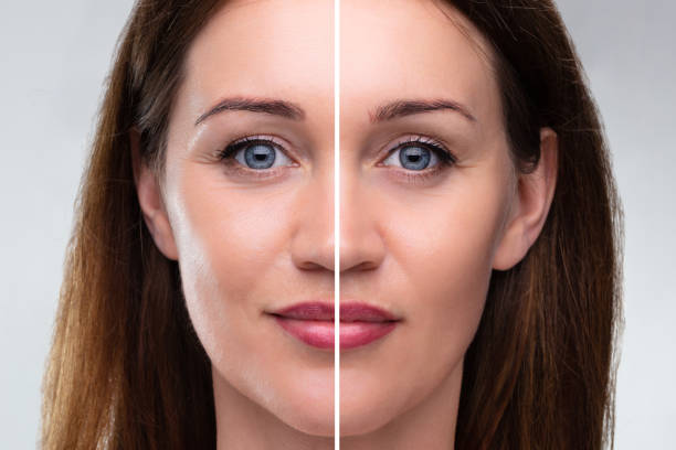 facelift surgery in riyadh
