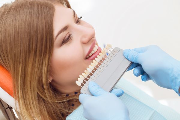 composite veneers in islamabad Pakistan