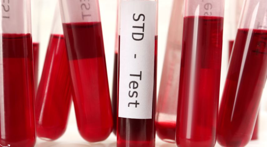 same day std testing london
