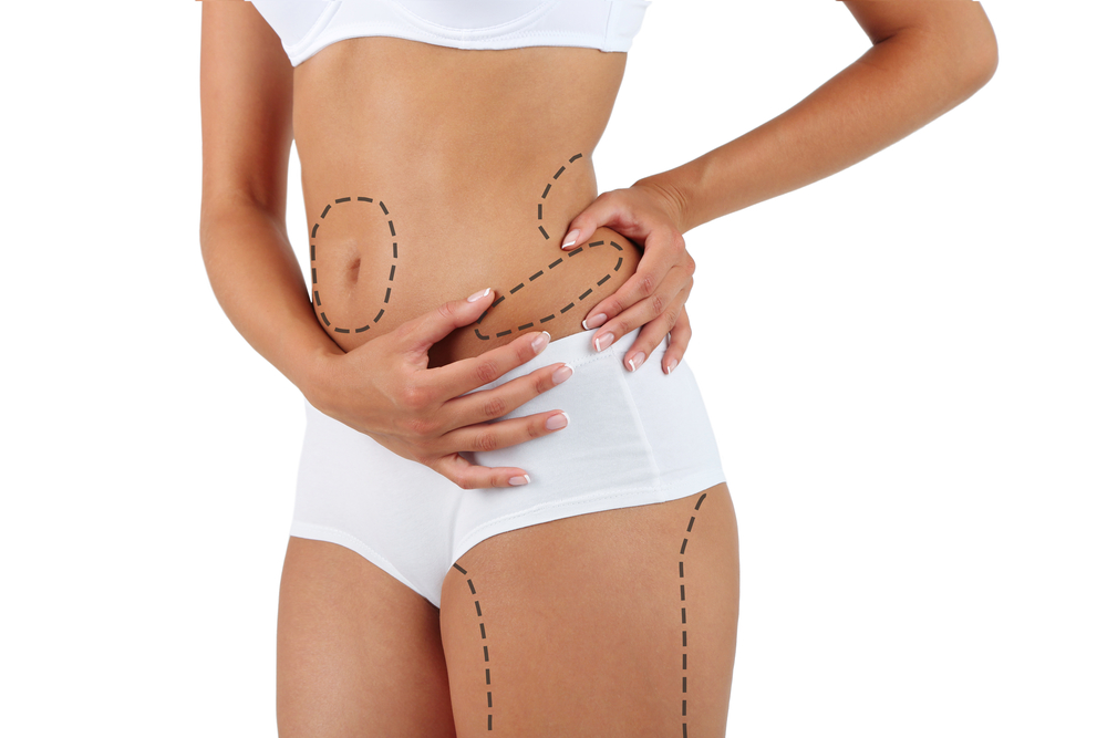 Liposuction in Riyadh